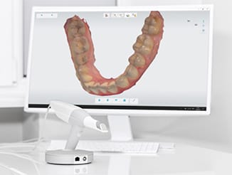 3D Scanner, Azarko Dental Group