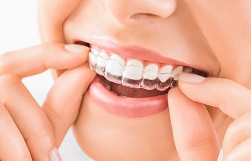 Orthodontics in Edmonton